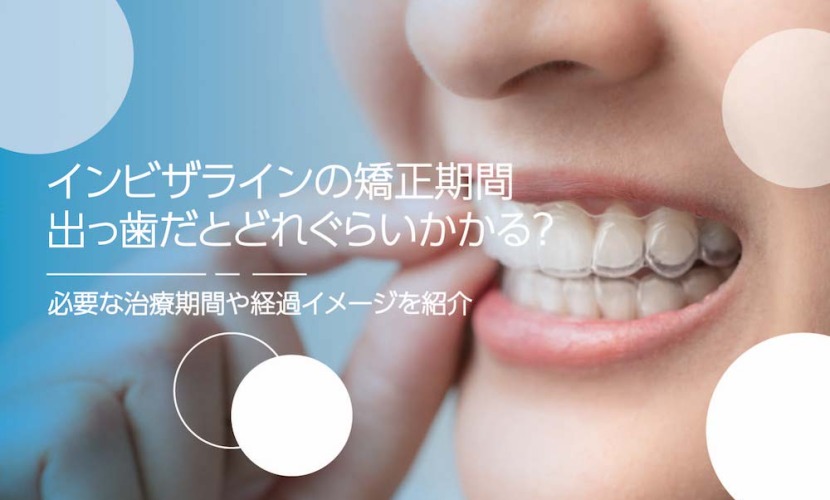 インビザラインの矯正期間、出っ歯だとどれぐらいかかる？必要な治療期間や治療の経過イメージを紹介