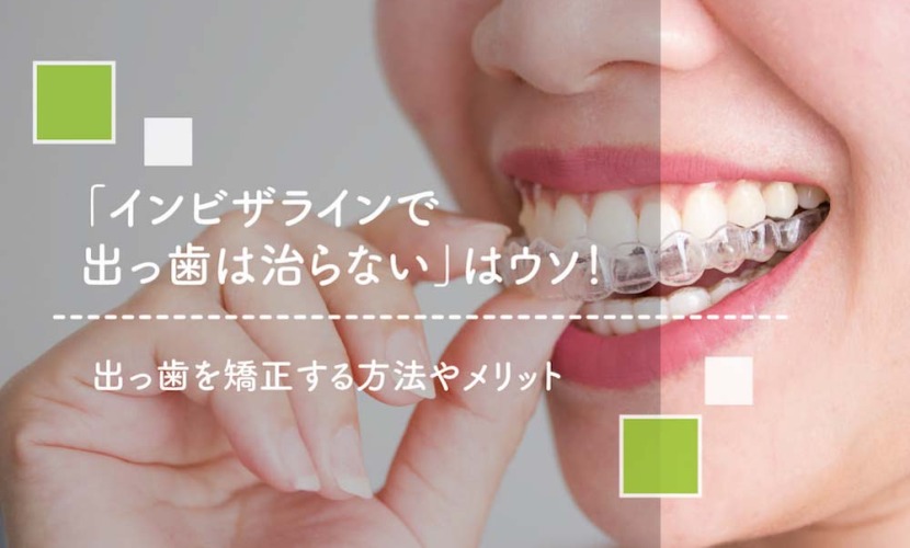 「インビザラインで出っ歯は治らない」はウソ！出っ歯を矯正する方法やメリットまとめ