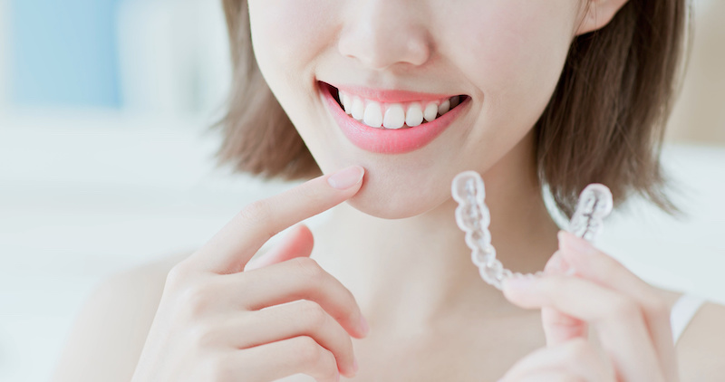 インビザラインの矯正期間、出っ歯だとどれぐらいかかる？治療期間や経過イメージを紹介